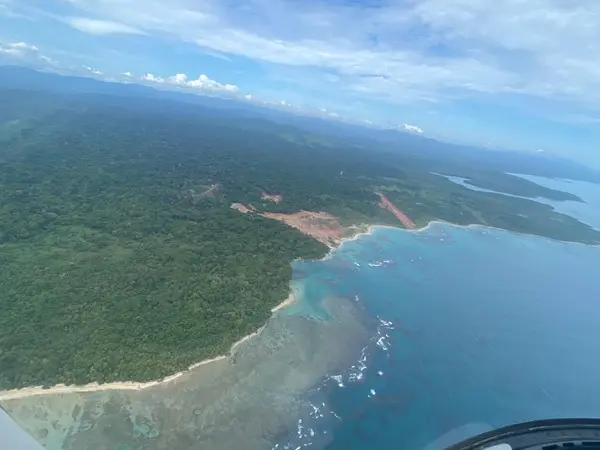 Colon